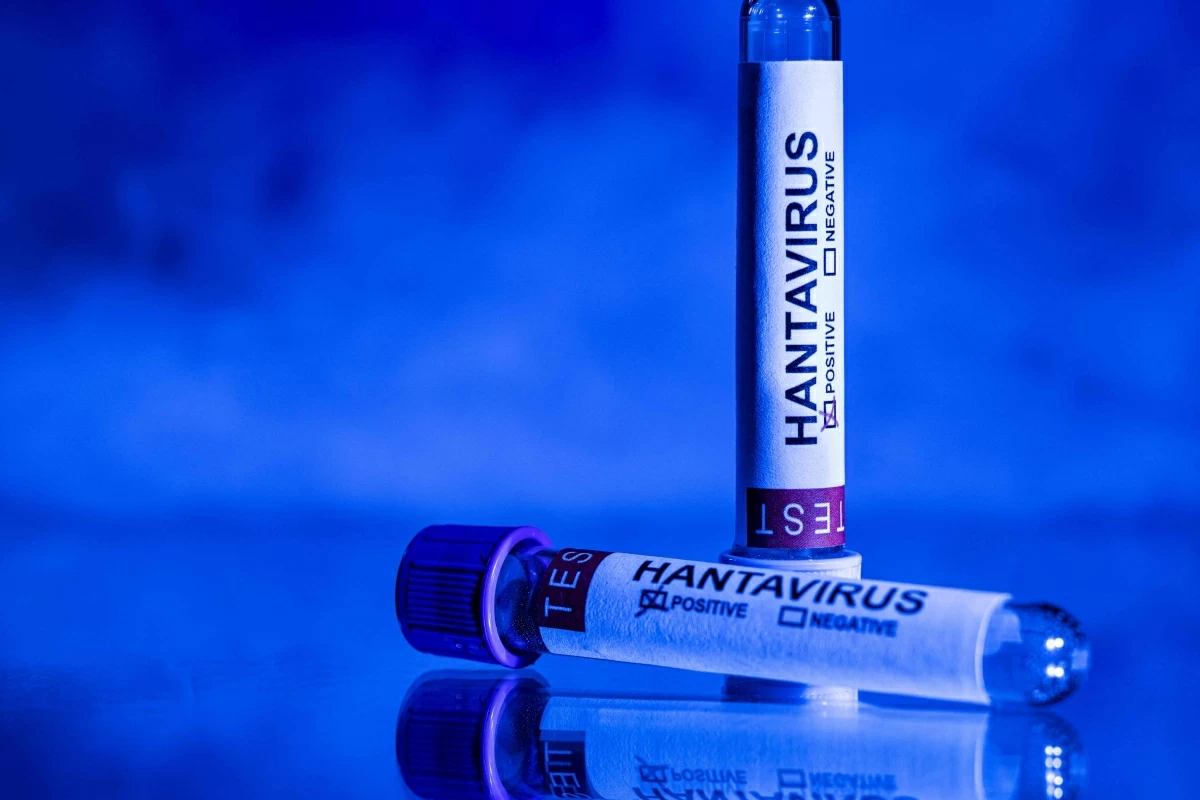 This photo taken in Paris on May 11, 2026 shows vials bearing the name of "hantivirus" (AFP photo) 