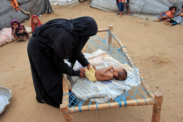 Yemen ‘step Away From Devastating Famine — Un Jordan Times