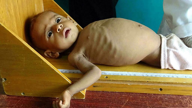 More than 45 per cent of Yemenis went hungry last year, making the conflict-hit country second only to Somalia for undernourishment in the Arab world, the UN FAO says Khaled Ziad (AFP photo)