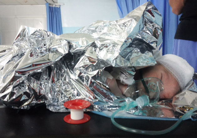 Majed, 27 days old, receives treatment from Médecins Sans Frontières at the Ramtha Hospital emergency room for a head injury caused by shrapnel from an explosive barrel bomb (Photo courtesy of MSF)