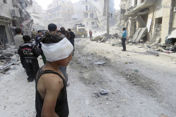 This image released by Thiqa News Agency shows an injured child after air strikes in Aleppo, Syria, on Wednesday (AP photo)