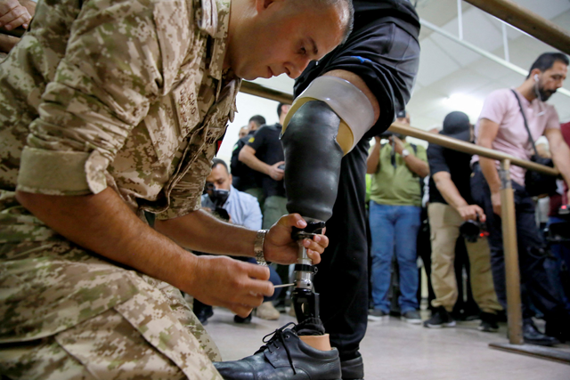 A doctor treats amputee at a rehabilitation centre in the King Hussein Medical City in Amman, which also deployed two Mobile Amputee Support Units (MASU) to the Jordanian field hospital in Gaza on August 26, 2024 (AFP photo)