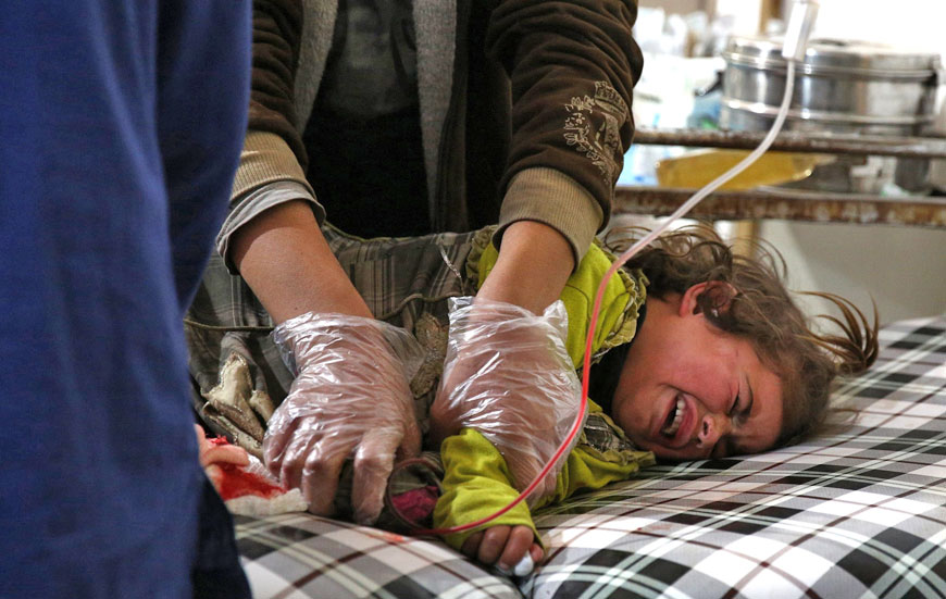 A Syrian girl is treated at a make-shift hospital, following a reported air strike by Syrian government forces on the rebel-held town of Douma, on the eastern edges of the Syrian capital Damascus, on December 5 (AFP photo)
