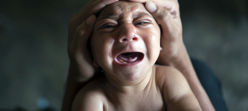 In this January 30 file photo, Jose Wesley, who was born with microcephaly and screams uncontrollably for long stretches, is attended to in Bonito, Pernambuco state, Brazil (AP photo)