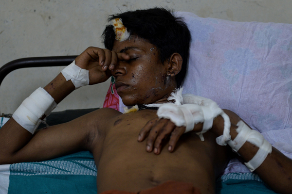 An injured victim of the deadly fire explosion that rocked the Hindu goddess, Puttingal Devi Temple in Paravoor, 60km North-West of Thiruvananthapuram in Kerala, sleeps at the Kollam Distict Hospital, on Sunday (AFP photo)