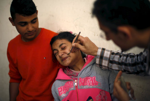 Palestinian girl Alya Al Ghafari, who suffers from facial palsy, receives bee-sting therapy at Rateb Samour's clinic in Gaza City on April 11 (Reuters photo)