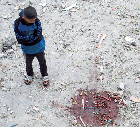 A Palestinian boy looks at a pool of blood at a UN-school housing displaced people that was hit during Israeli bombardment in Nuseirat, in the central Gaza Strip, on Thursday, amid the ongoing Israeli war on the Palestinian territory (AFP photo)