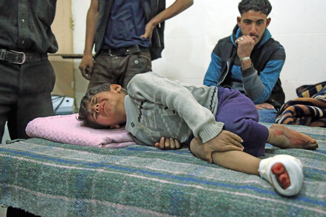 A wounded child lies on a bed at a makeshift hospital in the Eastern Ghouta town of Kafr Batna on the outskirts of Damascus, following reported shelling by government forces on the besieged rebel-held town of Haza on Saturday (AFP photo)