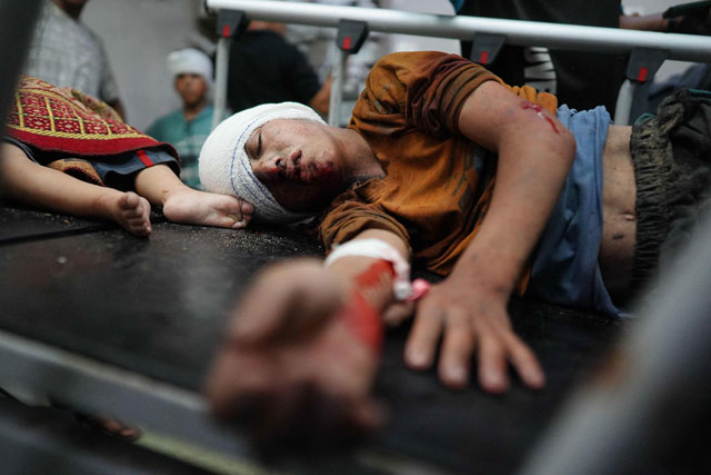 Palestinian children receive treatment at the Nasser hospital, where the injured and dead arrive following the Israeli military targeting of the southeastern district of Khan Yunis, in the southern Gaza Strip, on July 25, 2024 (AFP photo)