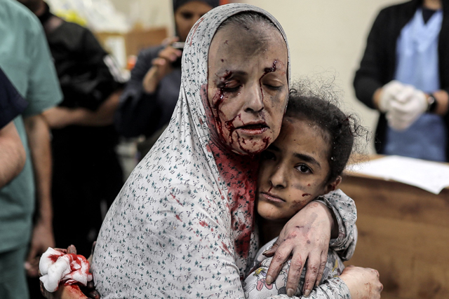 An injured Palestinian woman covered in dust and blood hugs an injured girl child at the hospital following the Israeli bombardment of Khan Yunis in the southern Gaza Strip on November 15 (AFP photo)