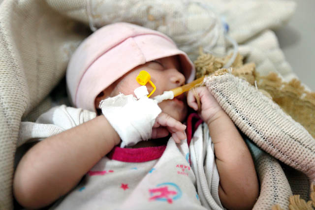 A Yemeni infant suspected of being infected with cholera receives treatment at Sabaeen Hospital in Sanaa on Tuesday (AFP photo)