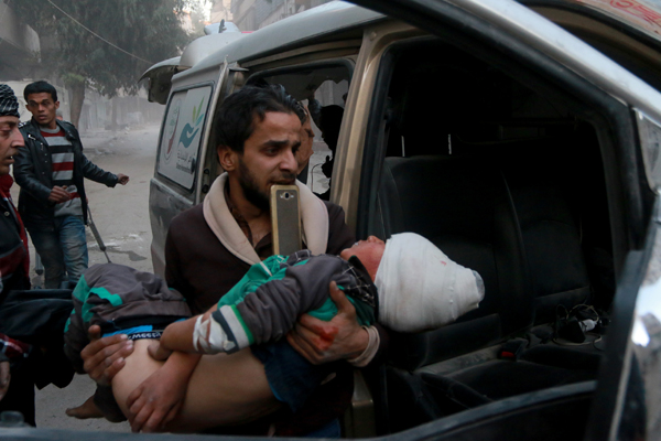 A man carries a wounded child after the air strikes carried out by the warplanes belonging to the regime forces on residential areas in Al-Shaer district, under siege by regime forces in Aleppo, Syria, on Sunday (Anadolu Agency photo)