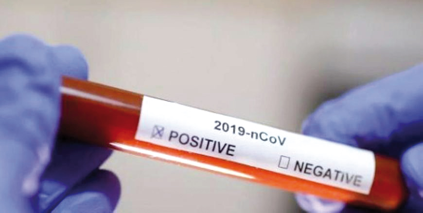 A total of 23,888 virus tests were conducted on Sunday, according to the government (Petra file photo)