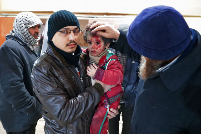 A Syrian child reacts at a makeshift hospital in the rebel-held town of Douma, on the eastern outskirts of Damascus, following reported air strikes, on Thursday (AFP photo)