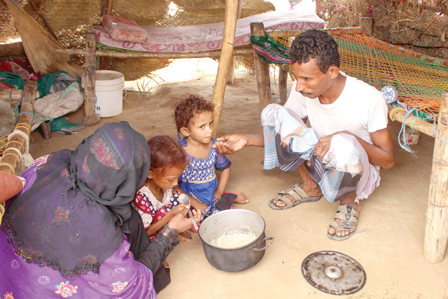 In this file photo taken on September 28, 2019, Samar Ali Jaidi (2nd left), a seven-year-old girl suffering from malnutrition, eats with her family at a makeshift camp for displaced Yemenis who fled fighting between the Houthi rebels and the Saudi-backed government, in the Abs district of the northwestern Hajjah province (AFP photo)
