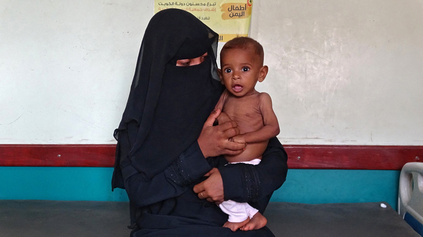 A mother sits next to her malnourished child at a treatment centre in Yemen's western province of Hodeida on Saturday (AFP photo)