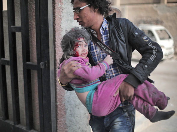 A Syrian photographer carries an injured girl following reported air strikes by regime forces on the town of Al Nashabiyah in the Eastern Ghouta region, a rebel stronghold east of the capital Damascus, on Monday (AFP photo)