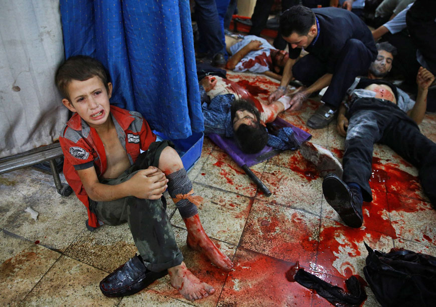A wounded Syrian boy sits on the floor next to men receiving treatment at a make-shift hospital in the rebel-held area of Douma, east of the capital Damascus, following reported air strikes by regime forces, on Wednesday (AFP photo)