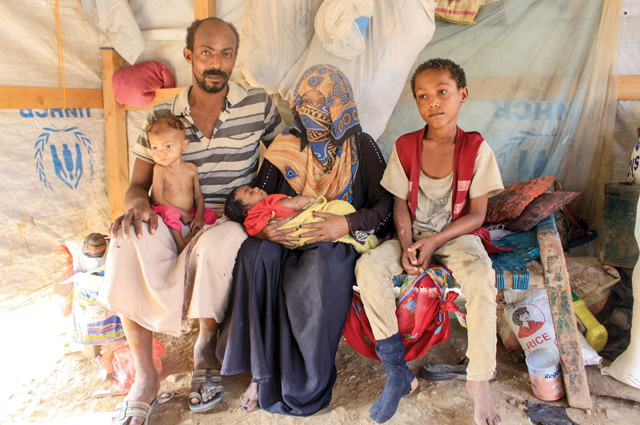 Three-year-old Yemeni child Randa Ali, suffering from severe acute malnutrition, is photographed with the members of her family in Al Khudash camp for displaced people in the Abs district of Yemen's northwestern Hajjah governorate, on Saturday (AFP photo)
