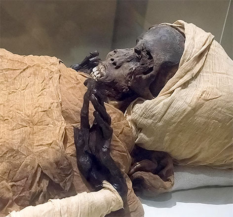 This handout photo released by the Egyptian ministry of tourism and antiquities on Wednesday shows a view of the mummy of ancient Egyptian King Seqenenre-Taa-II (AFP photo)