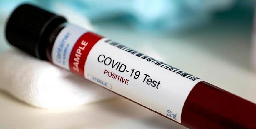 Epidemiological investigation teams on Thursday conducted 8,533 random tests nationwide, increasing the total number of tests to 400,933, according to a joint statement by the Prime Ministry and the Health Ministry (File photo)