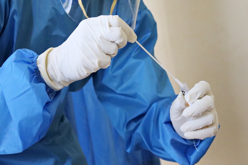 A total of 36,409 coronavirus virus tests were conducted on Tuesday (Photo courtesy of Unsplash.com)