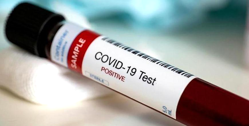 A total of 26,050 virus tests were conducted on Tuesday, bringing the cumulative number of coronavirus tests administered since the outbreak of the pandemic to 2,577,281, according to the government (Petra file photo)