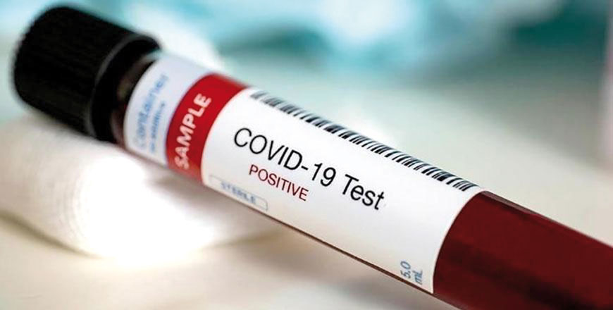 A total of 11,925 COVID-19 tests were conducted on Sunday, according to the government (Petra file photo)