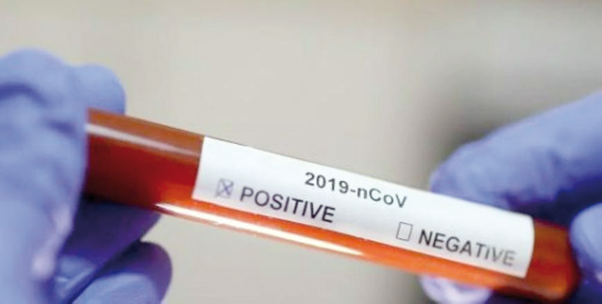 A total of 15,346 virus tests were conducted on Sunday, bringing the cumulative number of coronavirus tests administered since the outbreak of the pandemic to 7,260,498, according to the statement (JT file photo)