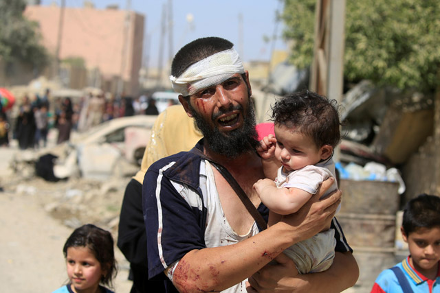  A wounded displaced Iraqi man who fled from clashes carries his child in western Mosul, Iraq, on Saturday (Reuters photo)