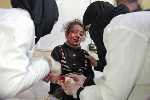 A Syrian girl who was injured in bombardment cries as she receives treatment at a makeshift hospital in the besieged rebel-held town of Douma, on the outskirts of the capital Damascus on Saturday (AFP photo)