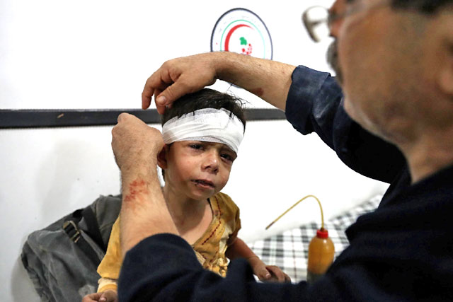 An injured Syrian child receives treatment at a makeshift hospital following a reported air strike on the rebel-held town of Douma, east of the capital Damascus, on Tuesday (AFP photo by Abd Doumany)