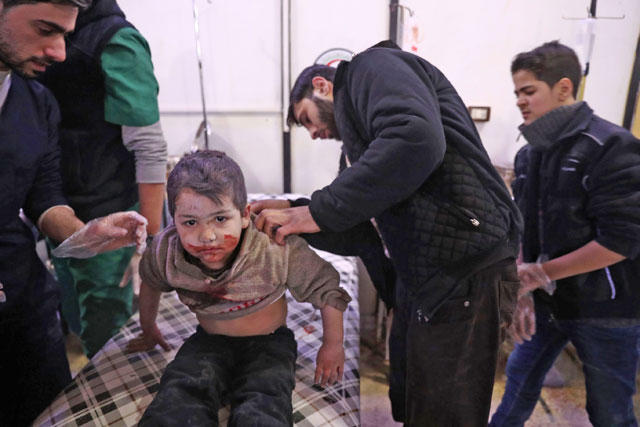 A wounded Syrian boy receives treatment at a make-shift hospital following a reported government air strike on the rebel-held town of Douma, on the eastern outskirts of the capital Damascus, on Sunday (AFP photo)