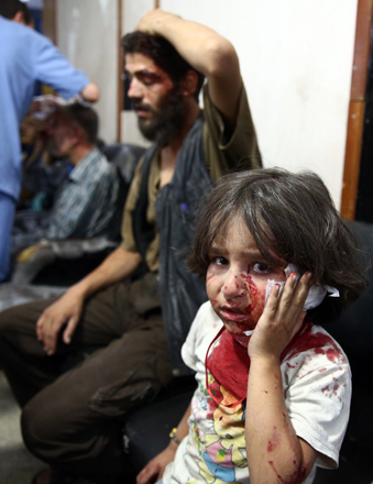 An injured girl sits awaiting treatment at a makeshift hospital in the rebel-held area of Douma, east of the capital Damascus, following reported air raids by Syrian government forces on Tuesday (AFP photo)
