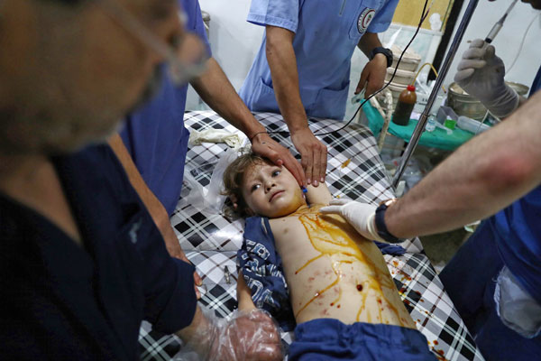An injured Syrian child receives treatment at a makeshift hospital following a reported air stike on the rebel-held town of Douma, east of the capital Damascus, on Sunday (AFP photo)