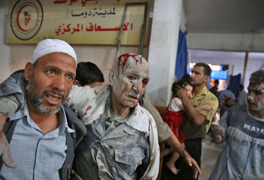 Wounded people arrive at a makeshift hospital in the rebel-held area of Douma, east of the Syrian capital Damascus, following reported air strikes by regime forces, on Tuesday (AFP photo)