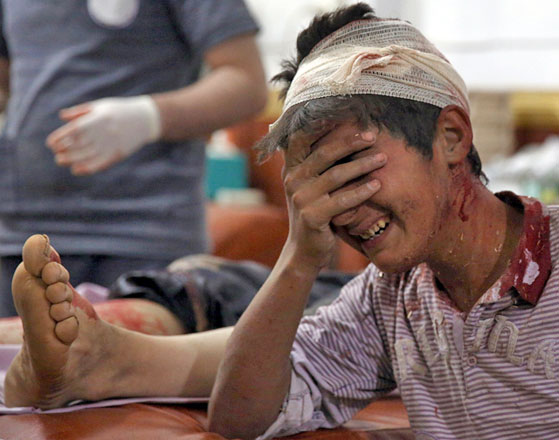 A wounded boy cries at a make-shift hospital in the rebel-held area of Douma, east of the Syrian capital Damascus, following reported air strikes by regime forces, on Tuesday (AFP photo)