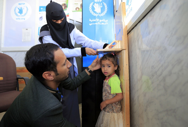 In this file photo taken on February 15, a Yemeni child suffering from malnutrition is measured at Al Sabeen maternity hospital in the Houthi-controlled capital Sanaa (AFP photo)