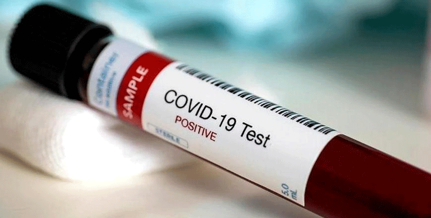 Epidemiological investigation teams on Thursday conducted 11,242 random virus tests nationwide, which is a ‘record number’ for a single day, increasing the total number of tests administered since the outbreak of the pandemic in the Kingdom to 861,330, according to the government (File photo)