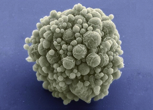 The syn3.0 cells contain the minimum amount of genes needed for life (Photo courtesy of hngn.com)