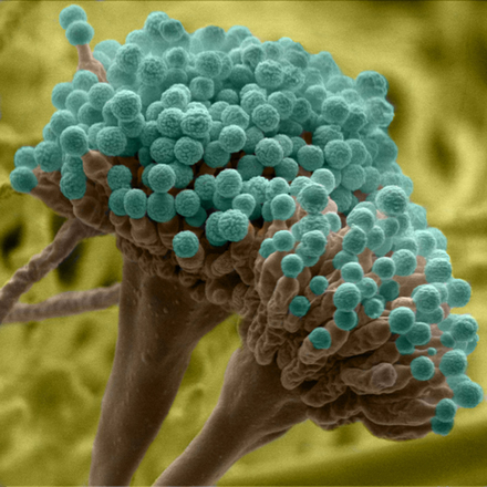  Moulds of the genus Aspergillus fungi (Photo courtesy of wordpress.com)