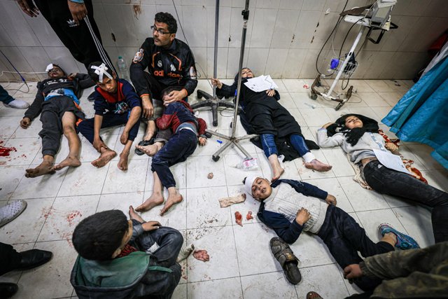 Members of the Al Qedra family, who were injured during Israeli bombardment, receive treatment at Nasser hospital in Khan Yunis on the southern Gaza Strip on Saturday, amid ongoing Israeli bombardment of Gaza (AFP photo)