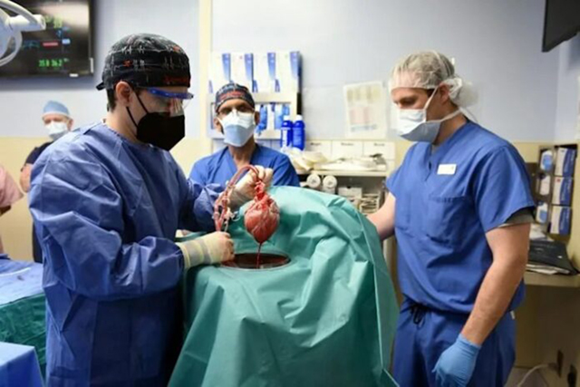 Surgeons prepare for transplantation of a heart from a genetically modified pig to patient in Baltimore, Maryland (AFP photo)