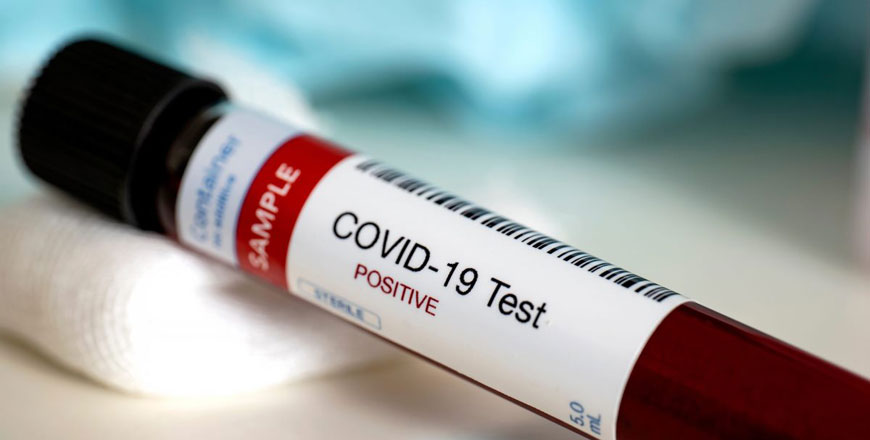 A total of 10,569 random virus tests were also conducted on Tuesday, bringing the cumulative number of coronavirus tests administered since the beginning of the crisis to 763,137, according to authorities (Petra file photo)