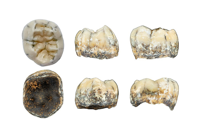 The fossilised molar, seen here from several angles, is thought to have belonged to a young Denisovan girl that died between 164,000 and 131,000 years ago  (AFP photo by F. Demeter)