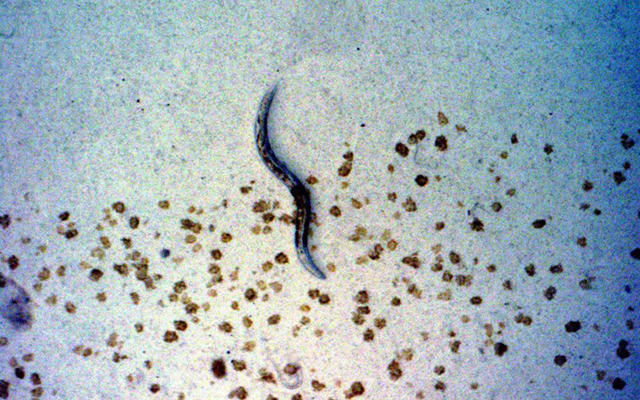 C elegan worm, seen under a microscope, is around one millimetre long, with an acute sense of smell (AFP photo)
