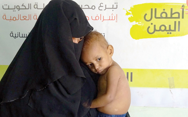 A nurse tends to a malnourished child at a treatment centre in Yemen's western province of Hodeida on Saturday (AFP photo)